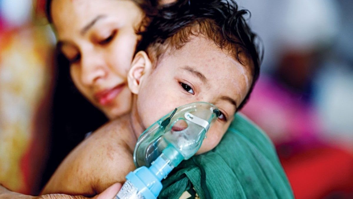 হামে আরও ৭ শিশুর মৃত্যু, আক্রান্ত ৮৮৭
