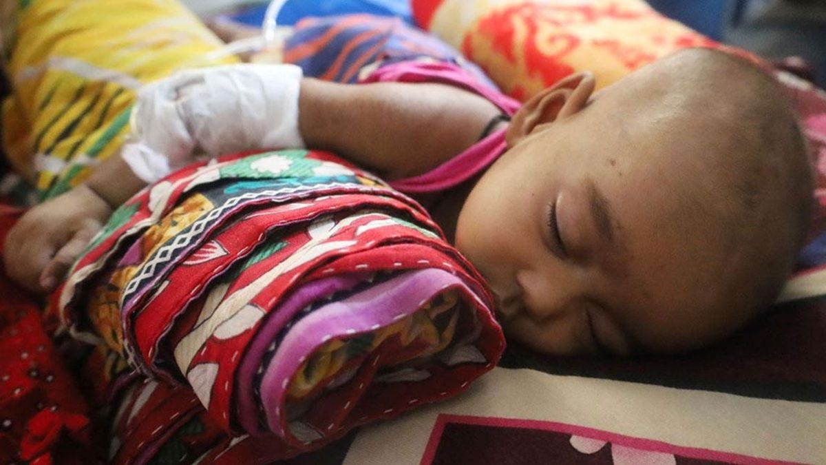 হাম ও উপসর্গে মৃত্যু ৭০০ ছাড়ালো