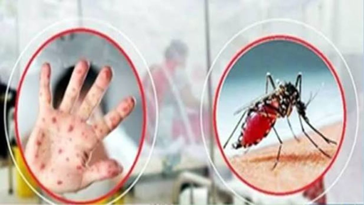 ‎হামের সঙ্গে চোখ রাঙাচ্ছে ডেঙ্গুও